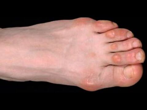 champignon sur le pied